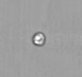 Apoptotic
